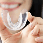 Night Guard/ Mouth Guard