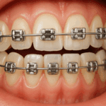 Orthodontics