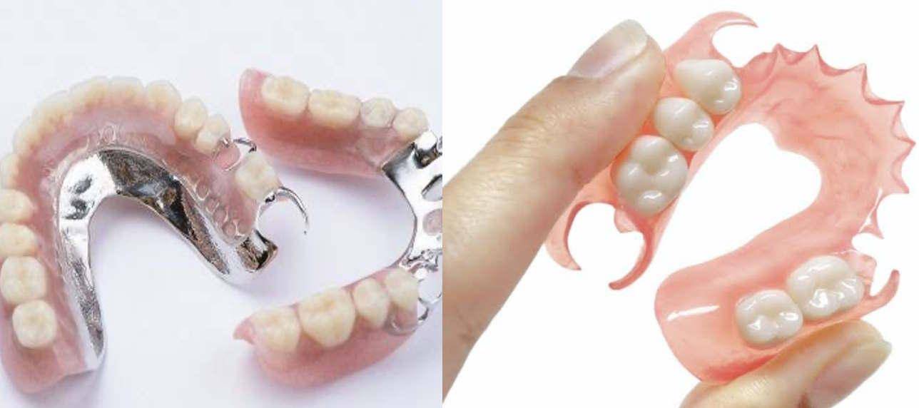 Partial Dentures or Acrylic Denture in Pattaya Thailand