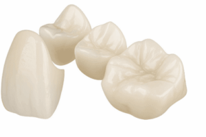 Tooth-coloured dental crowns and a three-unit bridge