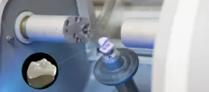 Dental milling machine shaping a zirconia restoration